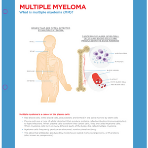 What is multiple myeloma
