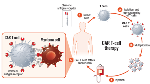 CAR T cells and the steps in CAR T-cell therapy including: 1. Collect cells, 2. Isolation, and reprogramming of T cells, 3. multiplication, 4. injection, 5. CAR T cells attack cancer cells.
